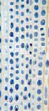 Εικ. 5.20 Φυτικά κύτταρα σε διάφορα στάδια μίτωσης, όπως φαίνονται στο οπτικό μικροσκόπιο.