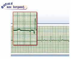 Η περιοδική κίνηση του καρδιακού μυός καταγράφεται με τη βοήθεια κατάλληλης συσκευής, του ηλεκτροκαρδιογράφου.