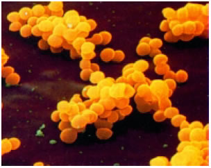 Eικόνα 1.5: Staphylococcus
