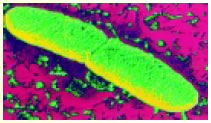 Yersinia pestis